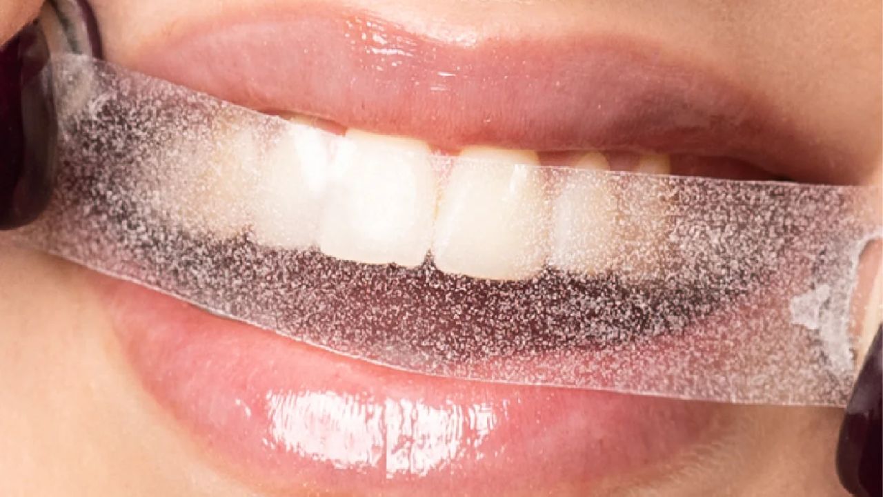 Exploring the Range of Teeth Whitening Strips: From Charcoal to Dissolving Solutions